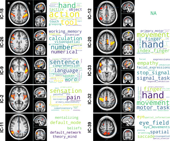 hand preference paper figure